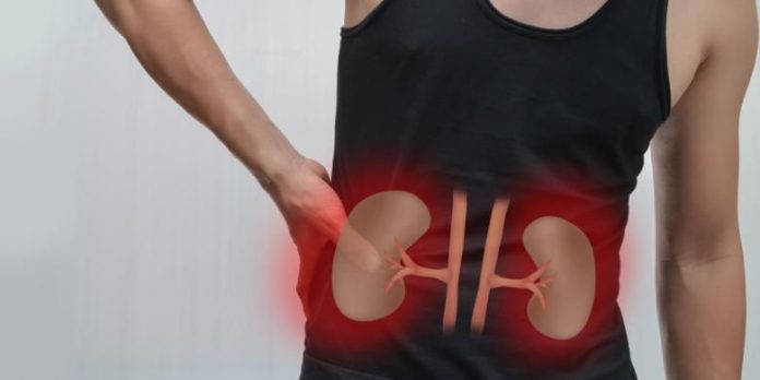 Selama ini, kita mengenal cuci darah dan transplantasi untuk mengobati gagal ginjal. Sementara ada alternatif lain penyembuhan yang dilakukan dengan terapi sel induk.(Shutterstock)